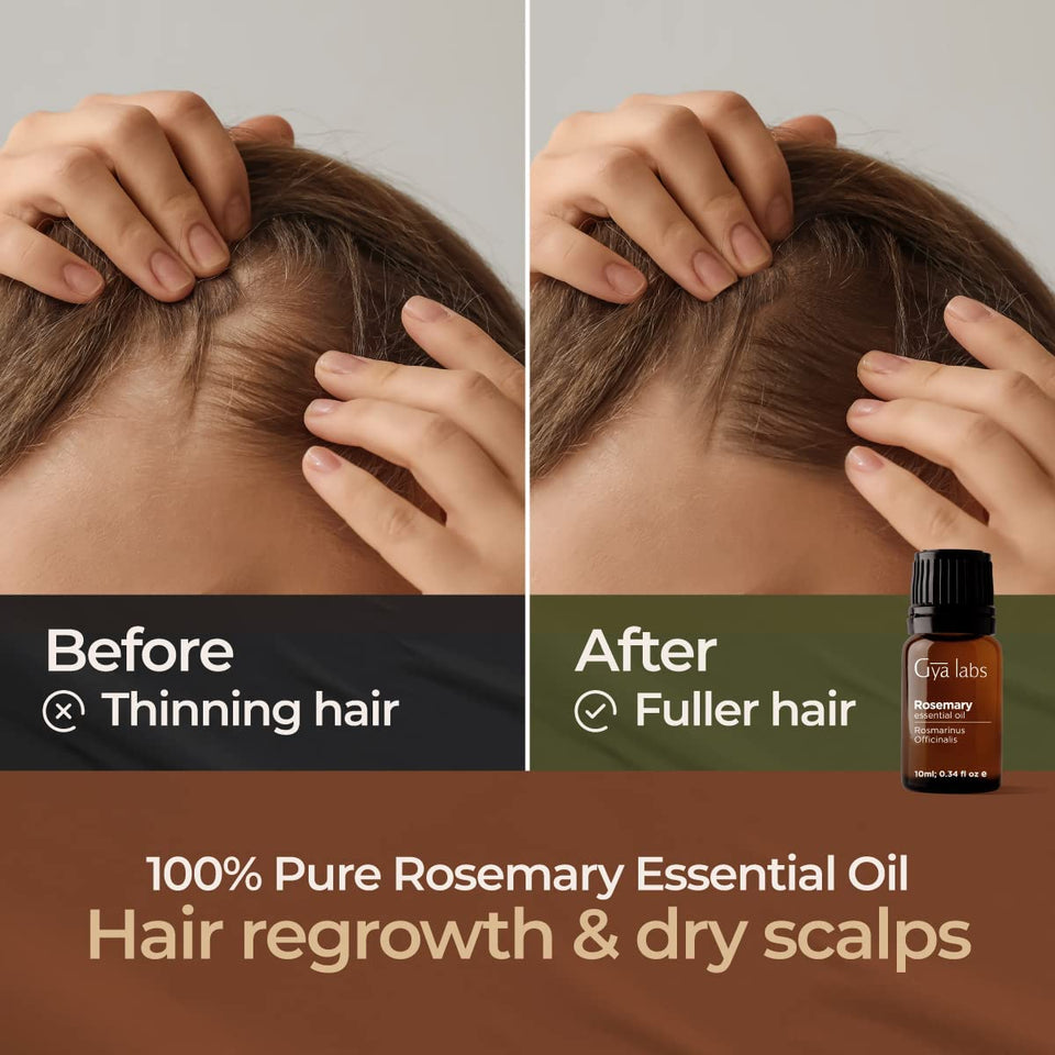 Pure Rosemary Oil for Hair Growth & Dry Scalp (10Ml) - 100% Therapeutic Grade Undiluted Rosemary Essential Oils for Hair Growth, Hair Loss, Skin & Diffuser